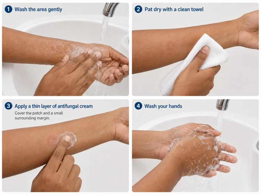 Four steps for cleaning, drying, and applying antifungal cream to a small ringworm rash.
